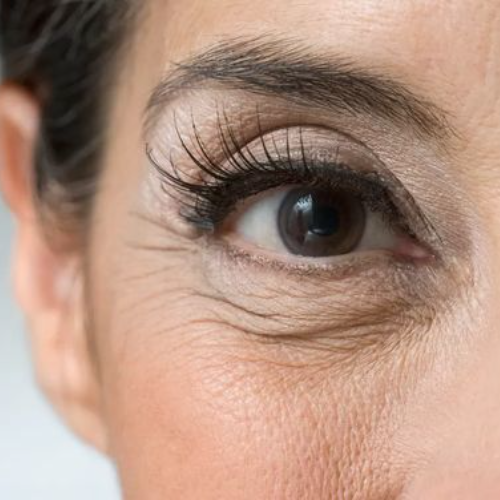 Understanding signs of aging & their effective treatment.